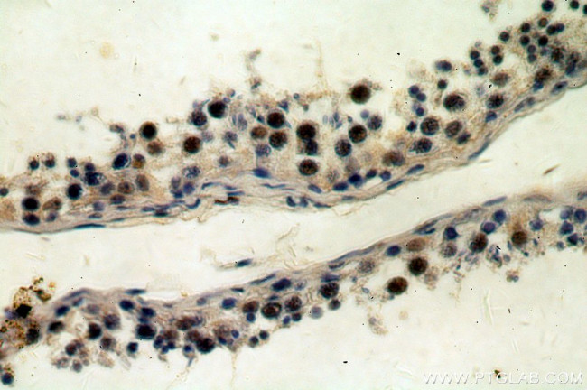 REXO4 Antibody in Immunohistochemistry (Paraffin) (IHC (P))