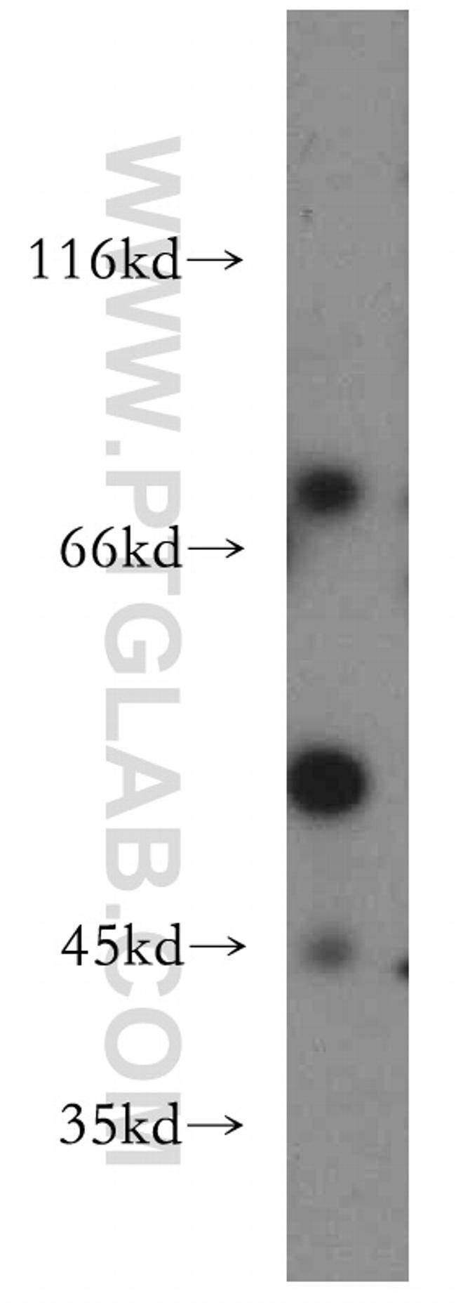 REXO4 Antibody in Western Blot (WB)