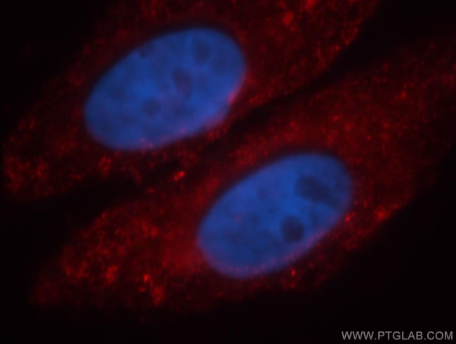 PTRF Antibody in Immunocytochemistry (ICC/IF)