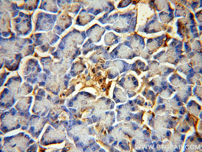 PTRF Antibody in Immunohistochemistry (Paraffin) (IHC (P))