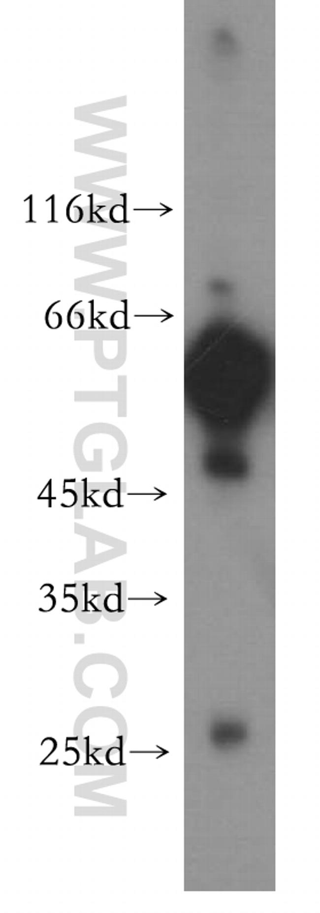 PTRF Antibody in Western Blot (WB)