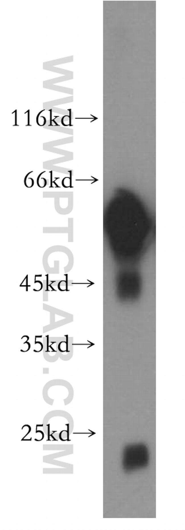 PTRF Antibody in Western Blot (WB)