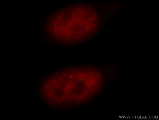 RBM16 Antibody in Immunocytochemistry (ICC/IF)