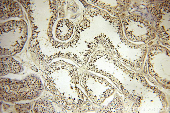 RBM16 Antibody in Immunohistochemistry (Paraffin) (IHC (P))