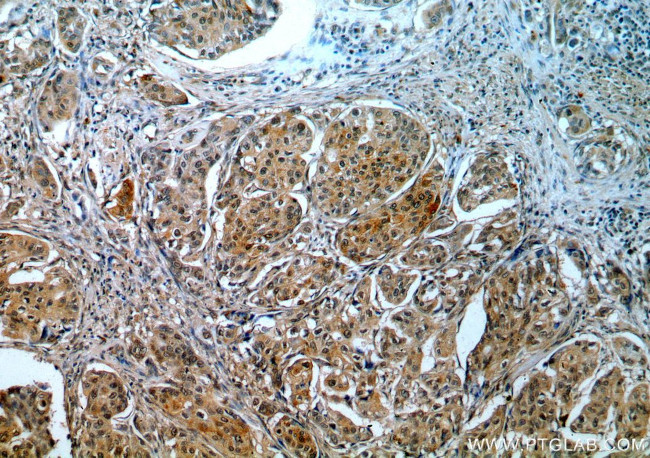 RBM16 Antibody in Immunohistochemistry (Paraffin) (IHC (P))