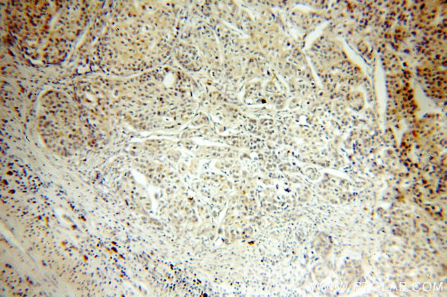 RBM16 Antibody in Immunohistochemistry (Paraffin) (IHC (P))