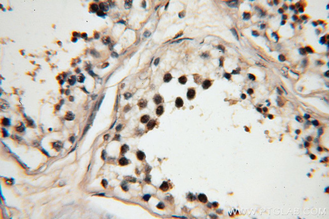 RBM16 Antibody in Immunohistochemistry (Paraffin) (IHC (P))