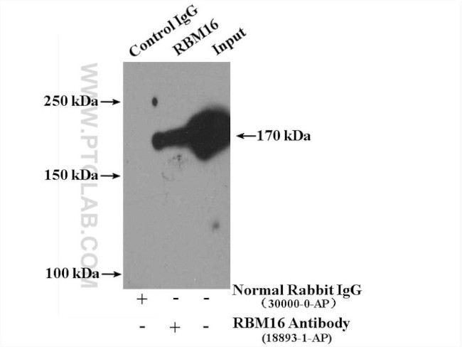 RBM16 Antibody in Immunoprecipitation (IP)