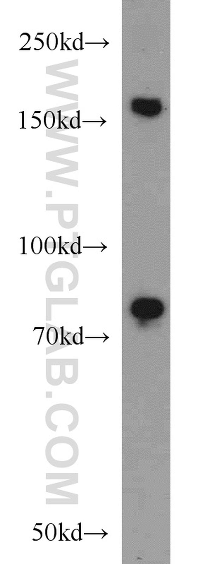 RBM16 Antibody in Western Blot (WB)