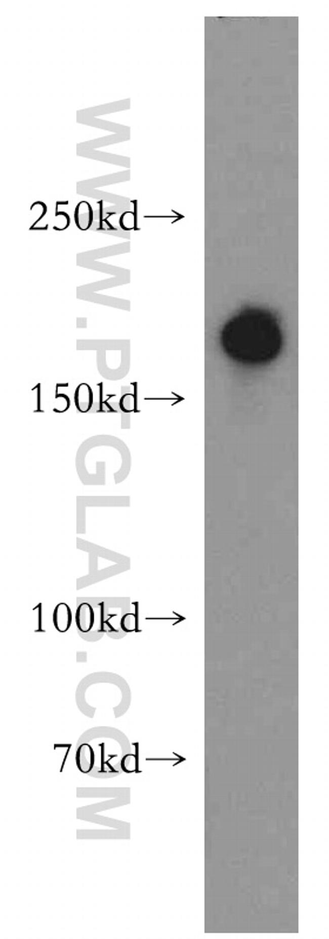 RBM16 Antibody in Western Blot (WB)