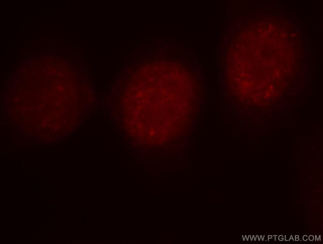 B-Myb Antibody in Immunocytochemistry (ICC/IF)