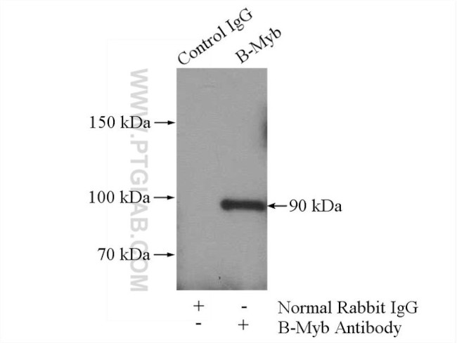 B-Myb Antibody in Immunoprecipitation (IP)