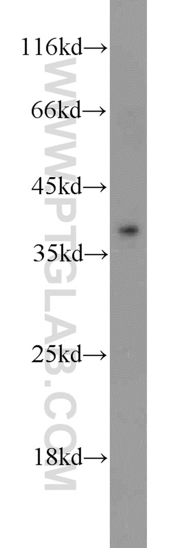 ADH1C Antibody in Western Blot (WB)