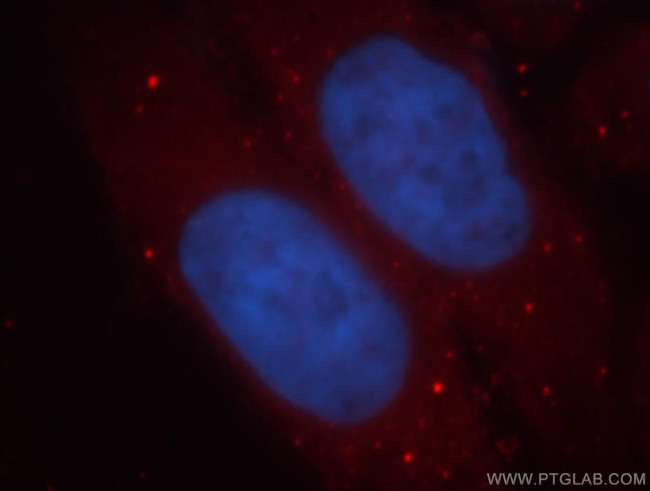 ADH1C Antibody in Immunocytochemistry (ICC/IF)