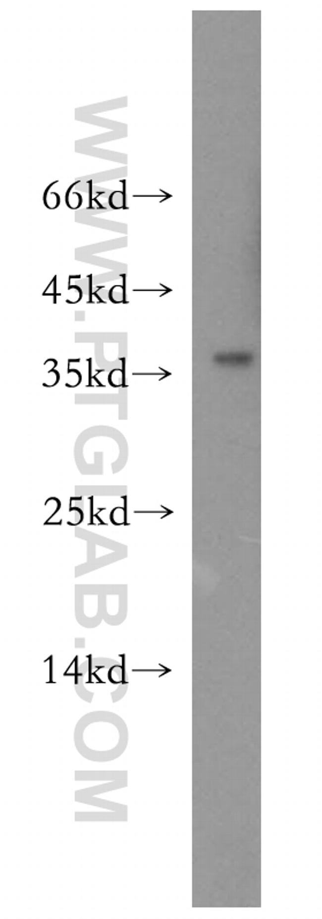 ADH1C Antibody in Western Blot (WB)