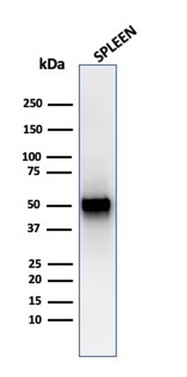 Thymidine Phosphorylase/PD-ECGF Antibody in Western Blot (WB)