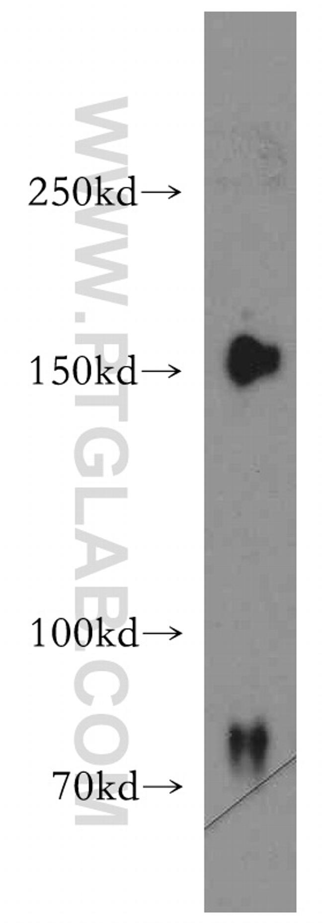 ZO-2 Antibody in Western Blot (WB)