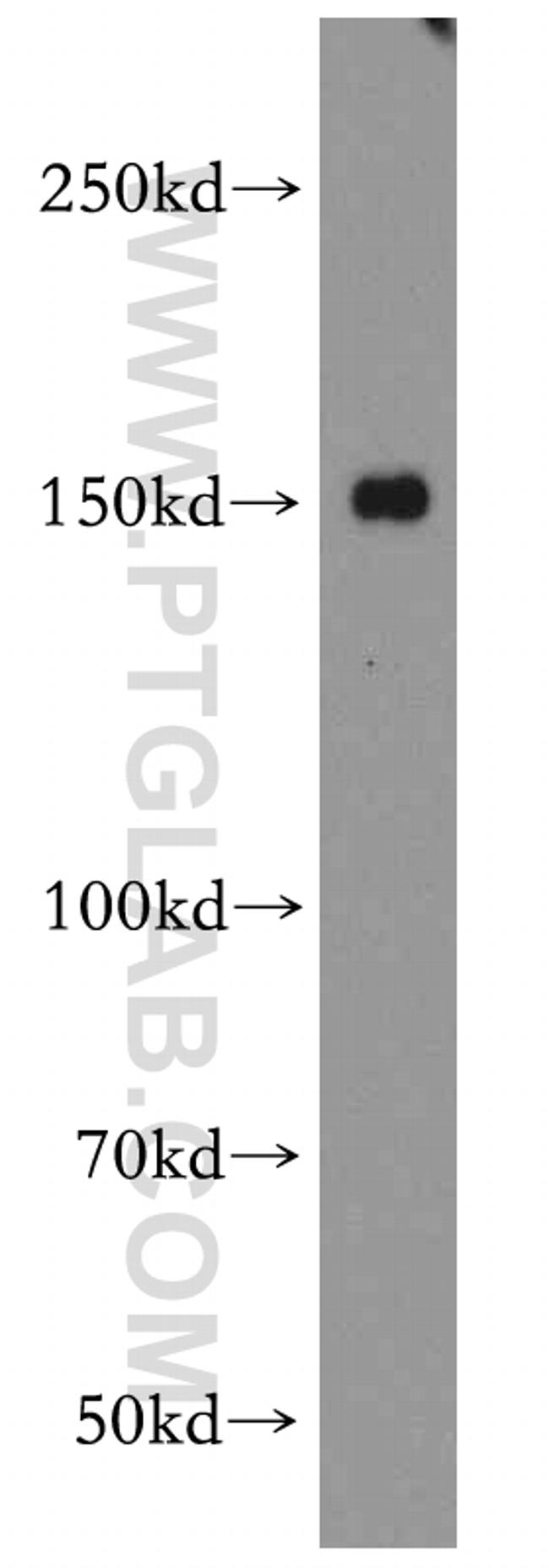 ZO-2 Antibody in Western Blot (WB)