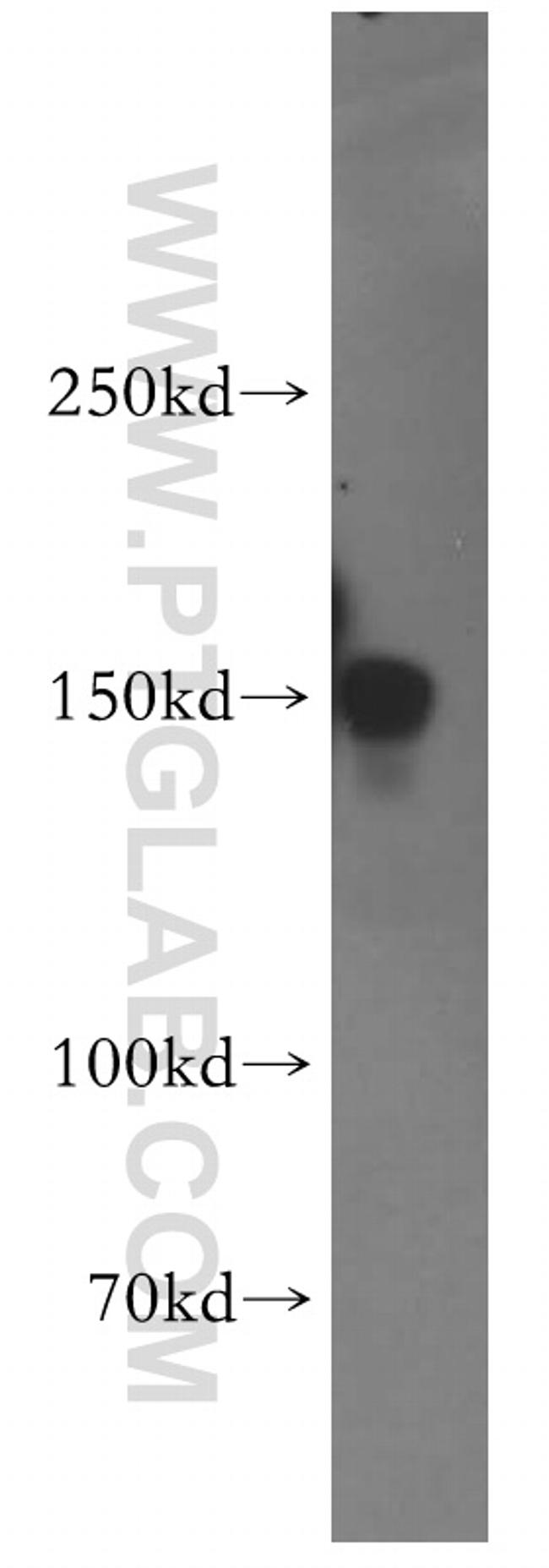ZO-2 Antibody in Western Blot (WB)