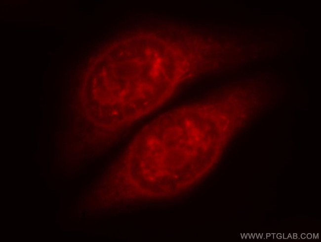 SOX13 Antibody in Immunocytochemistry (ICC/IF)