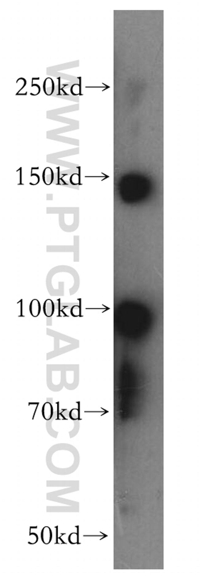 SOX13 Antibody in Western Blot (WB)