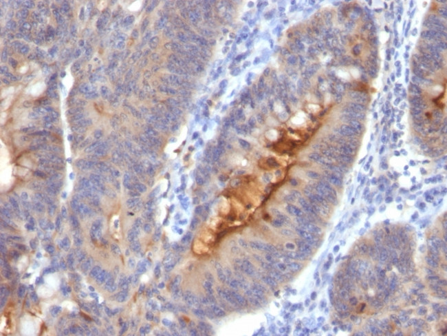 IgA Secretory Component/ECM1 Antibody in Immunohistochemistry (Paraffin) (IHC (P))