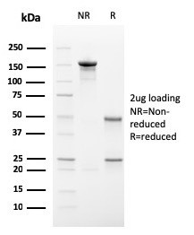 IgA Secretory Component/ECM1 Antibody in SDS-PAGE (SDS-PAGE)