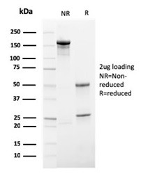 IgA Secretory Component/ECM1 Antibody in SDS-PAGE (SDS-PAGE)