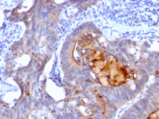 Secretory Component/ECM1 Antibody in Immunohistochemistry (Paraffin) (IHC (P))