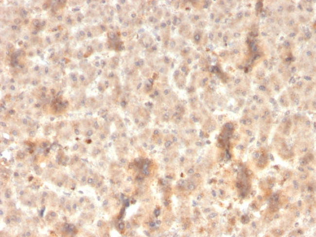 Secretory Component/ECM1 Antibody in Immunohistochemistry (Paraffin) (IHC (P))