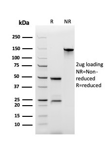 Secretory Component/ECM1 Antibody in SDS-PAGE (SDS-PAGE)