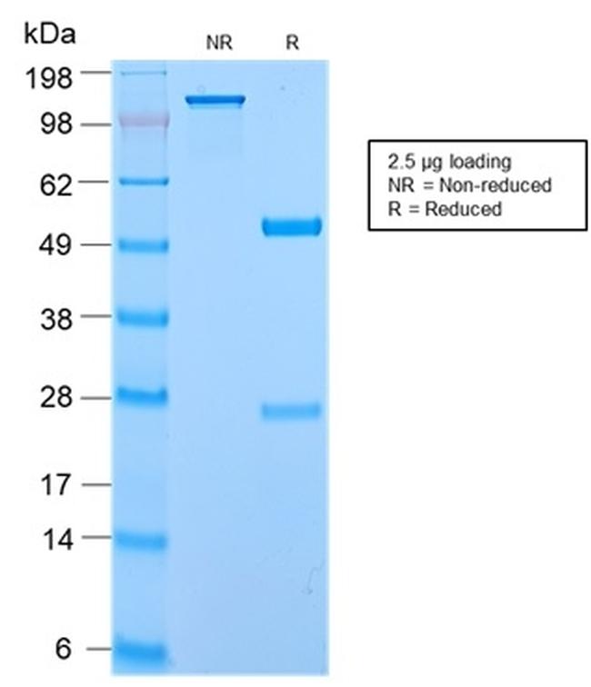 Secretory Component/ECM1 Antibody in SDS-PAGE (SDS-PAGE)