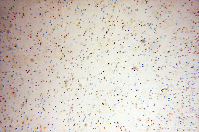 NDC80 Antibody in Immunohistochemistry (Paraffin) (IHC (P))