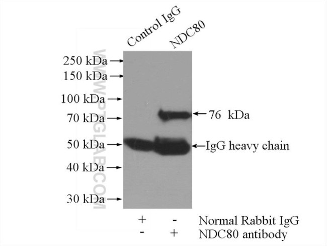 NDC80 Antibody in Immunoprecipitation (IP)