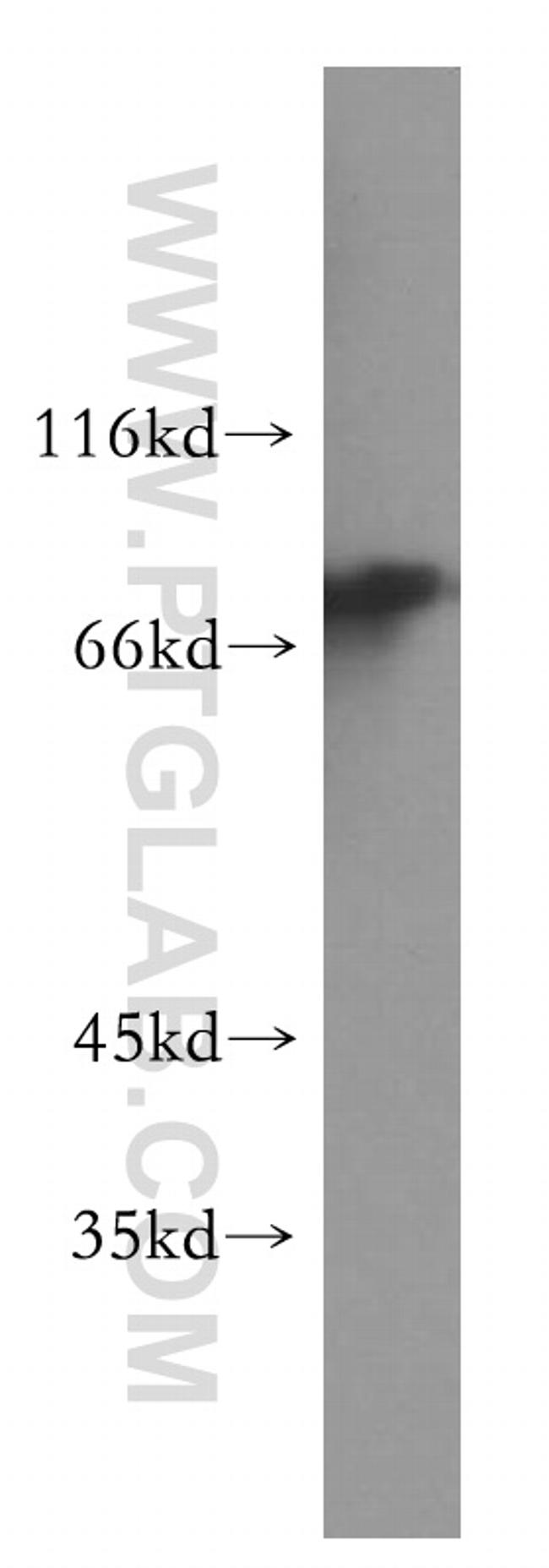 NDC80 Antibody in Western Blot (WB)