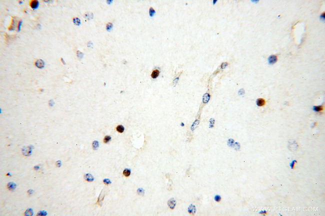 NDC80 Antibody in Immunohistochemistry (Paraffin) (IHC (P))