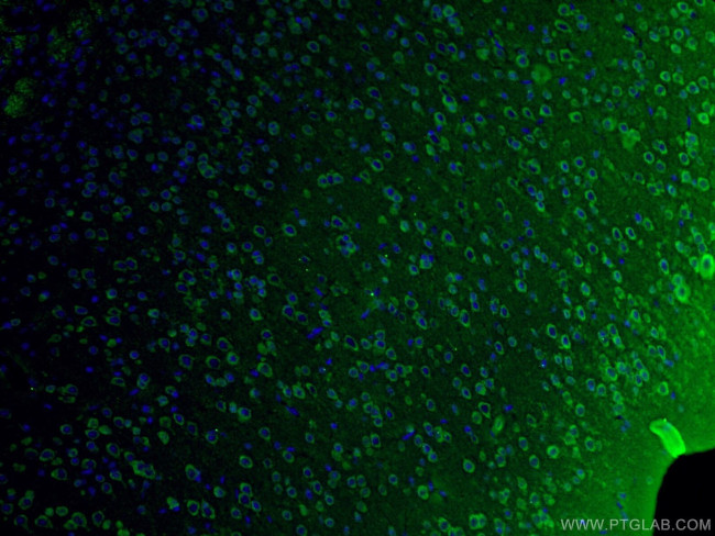 NF-H Antibody in Immunohistochemistry (PFA fixed) (IHC (PFA))