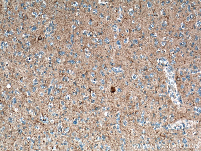 NF-H Antibody in Immunohistochemistry (Paraffin) (IHC (P))