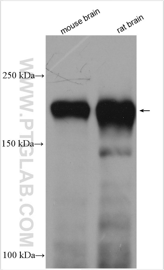 NF-H Antibody in Western Blot (WB)