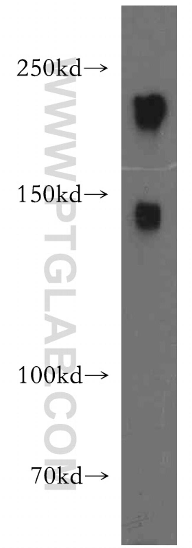 NF-H Antibody in Western Blot (WB)