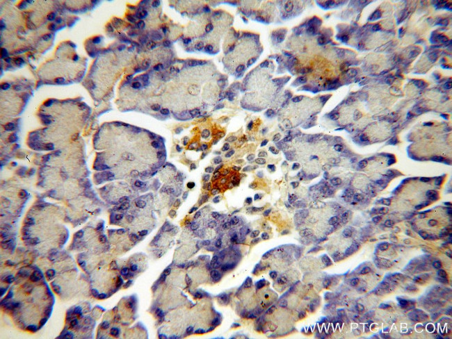 NECAB3 Antibody in Immunohistochemistry (Paraffin) (IHC (P))