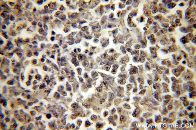 LSM7 Antibody in Immunohistochemistry (Paraffin) (IHC (P))