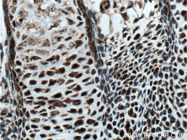 MYOD1 Antibody in Immunohistochemistry (Paraffin) (IHC (P))