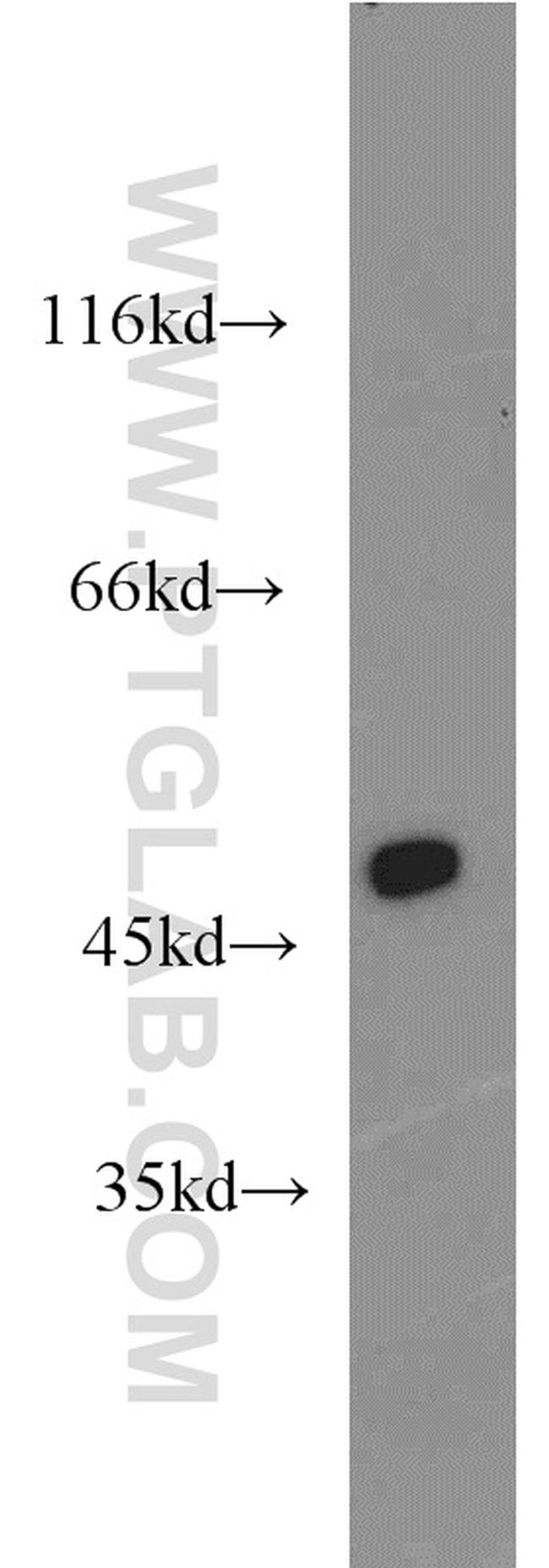 MYOD1 Antibody in Western Blot (WB)