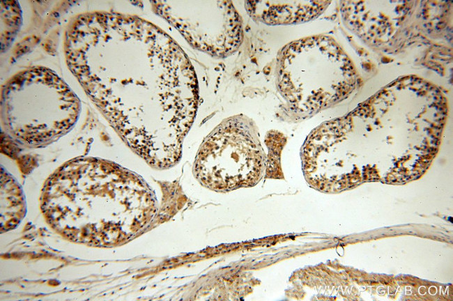 MYOD1 Antibody in Immunohistochemistry (Paraffin) (IHC (P))