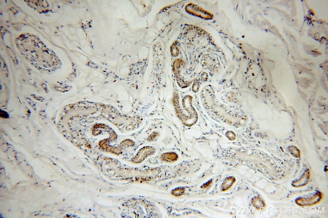 MYOD1 Antibody in Immunohistochemistry (Paraffin) (IHC (P))