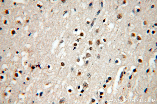 MYOD1 Antibody in Immunohistochemistry (Paraffin) (IHC (P))