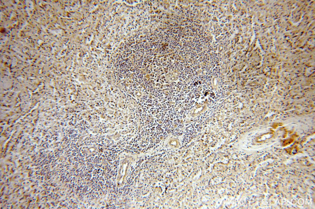 MYOD1 Antibody in Immunohistochemistry (Paraffin) (IHC (P))