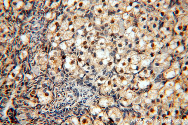 MYOD1 Antibody in Immunohistochemistry (Paraffin) (IHC (P))