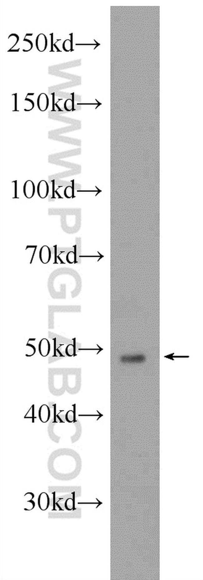 MYOD1 Antibody in Western Blot (WB)